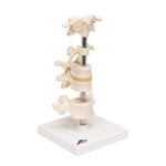Model of 6 Human Vertebrae, Mounted on Stand (atlas, axis, cervical, 2x thoracic, lumbar) - 3B Smart Anatomy