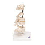 Model of 6 Human Vertebrae, Mounted on Stand (atlas, axis, cervical, 2x thoracic, lumbar) - 3B Smart Anatomy