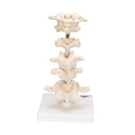 Model of 6 Human Vertebrae, Mounted on Stand (atlas, axis, cervical, 2x thoracic, lumbar) - 3B Smart Anatomy