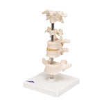 Model of 6 Human Vertebrae, Mounted on Stand (atlas, axis, cervical, 2x thoracic, lumbar) - 3B Smart Anatomy