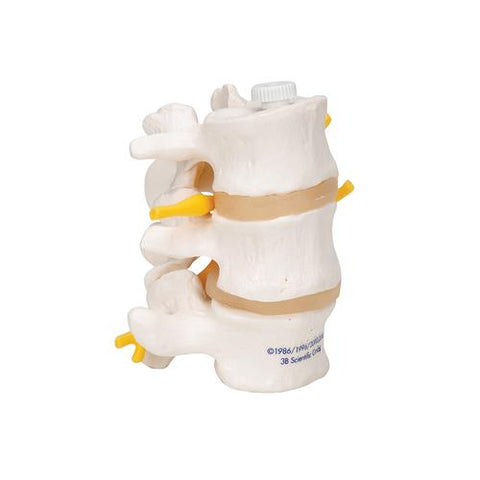 3 Human Lumbar Vertebrae, Flexibly Mounted - 3B Smart Anatomy