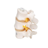 3 Human Lumbar Vertebrae, Flexibly Mounted - 3B Smart Anatomy