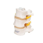 3 Human Lumbar Vertebrae, Flexibly Mounted - 3B Smart Anatomy