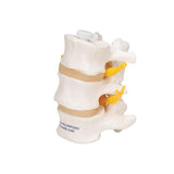 3 Human Lumbar Vertebrae, Flexibly Mounted - 3B Smart Anatomy
