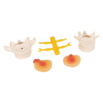 Human Lumbar Spinal Column with Prolapsed Intervertebral Disc - 3B Smart Anatomy