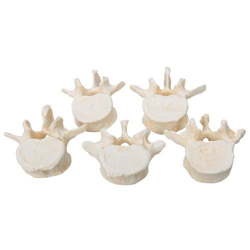 Set of 5 BONElike™ Lumbar Vertebrae - 3B Smart Anatomy