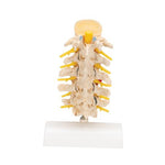 Stages of Disc Prolapse and Vertebral Degeneration - 3B Smart Anatomy