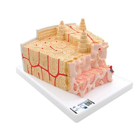 3B MICROanatomy™ Human Bone Structure, 80 times enlarged - 3B Smart Anatomy