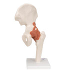 Functional Human Hip Joint Model - 3B Smart Anatomy