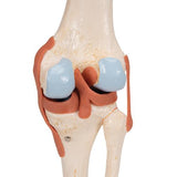 Functional Human Knee Joint Model with Ligaments & Marked Cartilage - 3B Smart Anatomy