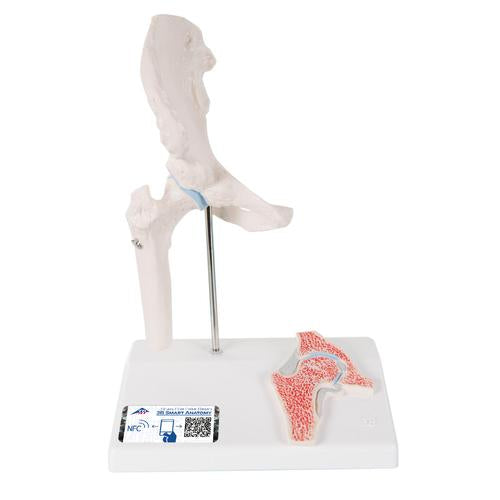 Mini Human Hip Joint Model with Cross Section - 3B Smart Anatomy