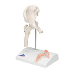 Mini Human Hip Joint Model with Cross Section - 3B Smart Anatomy
