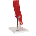 Human Elbow Joint Model with Removable Muscles, 8 parts - 3B Smart Anatomy