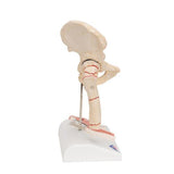 Human Femoral Fracture & Hip Osteoarthritis Model - 3B Smart Anatomy