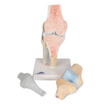 Sectional Human Knee Joint Model, 3 part - 3B Smart Anatomy