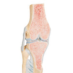 Sectional Human Knee Joint Model, 3 part - 3B Smart Anatomy