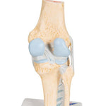 Sectional Human Knee Joint Model, 3 part - 3B Smart Anatomy