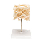 Human Cancellous Bone Model, Enlarged 100 times - 3B Smart Anatomy
