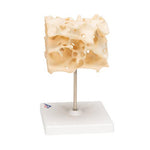 Human Cancellous Bone Model, Enlarged 100 times - 3B Smart Anatomy