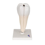Lower Twin-Root Molar with Cavities Human Tooth Model, 2 part - 3B Smart Anatomy