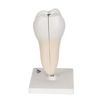 Lower Twin-Root Molar with Cavities Human Tooth Model, 2 part - 3B Smart Anatomy