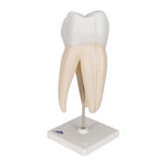 Upper Triple-Root Molar Human Tooth Model, 3 part - 3B Smart Anatomy