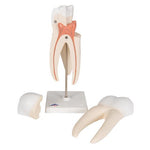 Upper Triple-Root Molar Human Tooth Model, 3 part - 3B Smart Anatomy