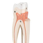 Upper Triple-Root Molar Human Tooth Model, 3 part - 3B Smart Anatomy