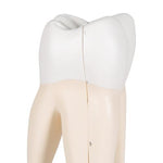 Upper Triple-Root Molar Human Tooth Model, 3 part - 3B Smart Anatomy