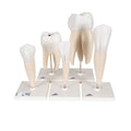 Human Tooth Models Set "Classic Series", 5 Models - 3B Smart Anatomy