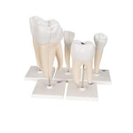 Human Tooth Models Set "Classic Series", 5 Models - 3B Smart Anatomy