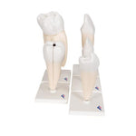 Human Tooth Models Set "Classic Series", 5 Models - 3B Smart Anatomy