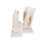Human Tooth Models Set "Classic Series", 5 Models - 3B Smart Anatomy