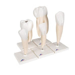 Human Tooth Models Set "Classic Series", 5 Models - 3B Smart Anatomy