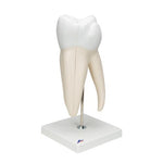 Giant Molar with Dental Cavities Human Tooth Model, 15 times Life-Size, 6 part - 3B Smart Anatomy