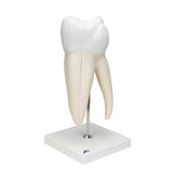 Giant Molar with Dental Cavities Human Tooth Model, 15 times Life-Size, 6 part - 3B Smart Anatomy