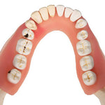Dental Disease Model, Magnified 2 times, 21 parts - 3B Smart Anatomy