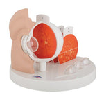 Pathological Human Eye Model - 3B Smart Anatomy
