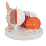 Pathological Human Eye Model - 3B Smart Anatomy