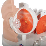 Pathological Human Eye Model - 3B Smart Anatomy