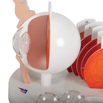 Pathological Human Eye Model - 3B Smart Anatomy