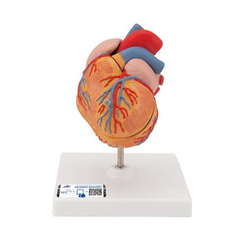 Classic Human Heart Model with Left Ventricular Hypertrophy (LVH), 2 part - 3B Smart Anatomy