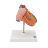 Classic Human Heart Model with Left Ventricular Hypertrophy (LVH), 2 part - 3B Smart Anatomy