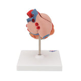 Classic Human Heart Model with Left Ventricular Hypertrophy (LVH), 2 part - 3B Smart Anatomy