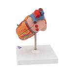 Classic Human Heart Model with Left Ventricular Hypertrophy (LVH), 2 part - 3B Smart Anatomy