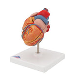 Classic Human Heart Model with Left Ventricular Hypertrophy (LVH), 2 part - 3B Smart Anatomy