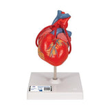 Classic Human Heart Model with Bypass, 2 part - 3B Smart Anatomy