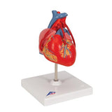 Classic Human Heart Model with Bypass, 2 part - 3B Smart Anatomy