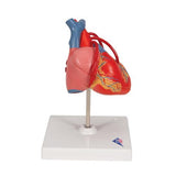 Classic Human Heart Model with Bypass, 2 part - 3B Smart Anatomy