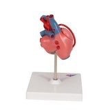 Classic Human Heart Model with Bypass, 2 part - 3B Smart Anatomy